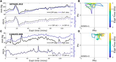 Intracranial pressure-flow relationships in traumatic brain injury patients expose gaps in the tenets of models and pressure-oriented management